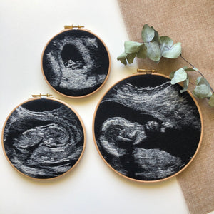 Personalised Ultrasound Art - Final Payment