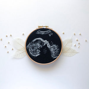 Personalised Ultrasound Art - Final Payment